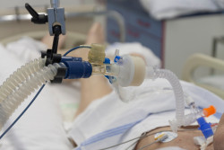 Die Beatmungsentwöhnung (Weaning) ist ein komplexer Prozess, der am Ende aber wieder mehr Lebensqualität und ein Stück Freiheit für Patient:innen bedeutet. | © Kliniken Beelitz / Adobe Stock